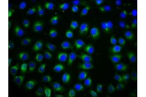Immunofluorescence staining of A549 cells with ABIN7171846 at 1:133, counter-stained with DAPI. (TSPAN12 anticorps  (AA 111-224))