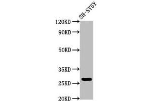 Western Blot Positive WB detected in: SH-SY5Y whole cell lysate All lanes: CD99L2 antibody at 4 μg/mL Secondary Goat polyclonal to rabbit IgG at 1/50000 dilution Predicted band size: 28, 23, 21, 16, 29 kDa Observed band size: 28 kDa (CD99L2 anticorps  (AA 26-145))