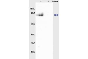 L1 mouse brain lysates L2 mouse heart lysates probed with Anti MMP9 Polyclonal Antibody, Unconjugated (ABIN873171) at 1:200 overnight at 4 °C.