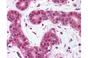 anti-B-Cell CLL/lymphoma 10 (BCL10) (N-Term) antibody