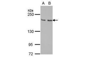 Image no. 1 for anti-Kinesin Family Member 14 (KIF14) (N-Term) antibody (ABIN1494038) (KIF14 anticorps  (N-Term))