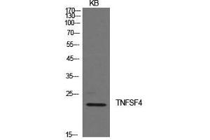 Western Blot (WB) analysis of KB cells using Ox40L Polyclonal Antibody.