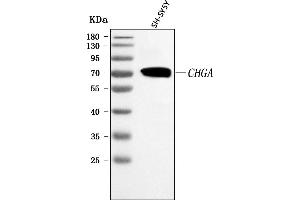 Western blot analysis of Chromogranin A/CHGA using anti-Chromogranin A/CHGA antibody (ABIN7600415).