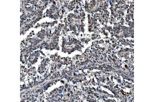 IHC analysis of VPRBP/DCAF1 using anti-VPRBP/DCAF1 antibody (ABIN7599063). (DDB1 and CUL4-Associated Factor 1 (DCAF1) (AA 1-195) anticorps)