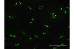 Immunofluorescence of purified MaxPab antibody to PNO1 on HeLa cell.