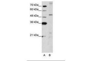 Image no. 1 for anti-Zinc Finger Protein 596 (ZNF596) (AA 424-473) antibody (ABIN203183) (ZNF596 anticorps  (AA 424-473))