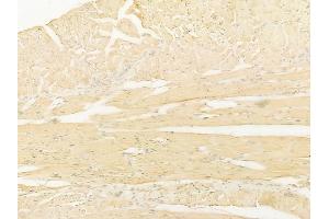 ABIN6266027 and ABIN6267216 at 1/100 staining human tongue carcinoma by IHC-P. (WIPI2 anticorps  (C-Term))