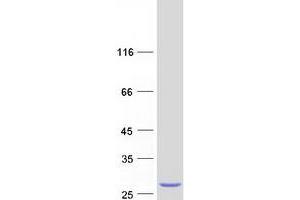 Validation with Western Blot