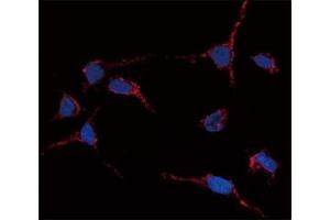 Immunofluorescence analysis of anti-ALDH1A1 antibody and HeLa cells.