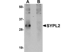 Western Blotting (WB) image for anti-Synaptophysin-Like 2 (SYPL2) (C-Term) antibody (ABIN1030718) (SYPL2 anticorps  (C-Term))