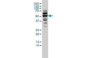 CAP2 monoclonal antibody (M01), clone 3G9-1A5 Western Blot analysis of CAP2 expression in C32 .