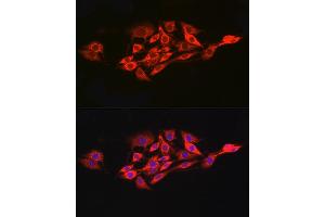 Immunofluorescence analysis of PC-12 cells using IL15RA Rabbit pAb (ABIN3017117, ABIN1680439 and ABIN7101500) at dilution of 1:100 (40x lens). (IL15RA anticorps  (AA 31-205))