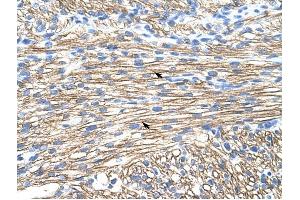 MBNL1 antibody was used for immunohistochemistry at a concentration of 4-8 ug/ml to stain Myocardial cells (arrows) in Human Liver. (MBNL1 anticorps)