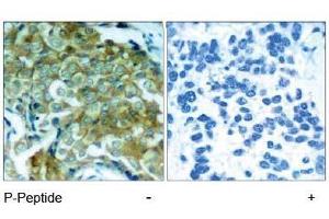 Image no. 1 for anti-Epidermal Growth Factor Receptor (EGFR) (pTyr1172) antibody (ABIN196960) (EGFR anticorps  (pTyr1172))