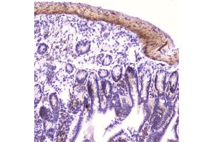 IHC analysis of IGFBP2 using anti-IGFBP2 antibody (ABIN5693239).
