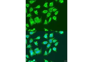 Immunofluorescence analysis of U2OS cells using MCCC2 antibody  at dilution of 1:100.