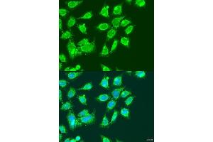 Immunofluorescence analysis of U2OS cells using MCCC2 antibody  at dilution of 1:100. (MCCC2 anticorps  (AA 284-563))