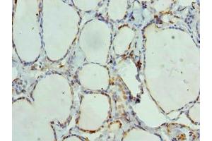 Immunohistochemistry of paraffin-embedded human thyroid tissue using ABIN7144163 at dilution of 1:100 (ANKMY1 anticorps  (AA 1-220))