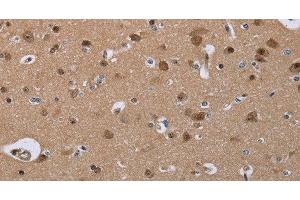 Immunohistochemistry of paraffin-embedded Human brain using CDK5 Polyclonal Antibody at dilution of 1:30 (CDK5 anticorps)