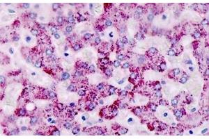 Human, Liver: Formalin-Fixed Paraffin-Embedded (FFPE)