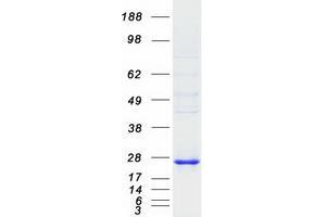 Validation with Western Blot