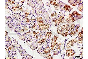 Immunohistochemistry (IHC) image for anti-2',3'-Cyclic Nucleotide 3' phosphodiesterase (CNP) (AA 151-250) antibody (ABIN730738)