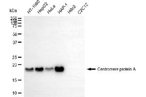Western blotting analysis using centromere protein A antibody (ABIN7798023).