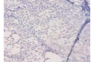 Immunohistochemistry of paraffin-embedded human prostate tissue using ABIN7155589 at dilution of 1:50 (HLA-DQA1 anticorps  (AA 24-213))