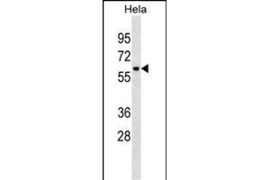 ZN Antibody (C-term) (ABIN1882025 and ABIN2838410) western blot analysis in Hela cell line lysates (35 μg/lane). (ZNF410 anticorps  (C-Term))
