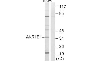 Western blot analysis of extracts from HUVEC cells, using AKR1B1 antibody. (AKR1B1 anticorps)