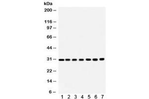 Western blot testing of 1) rat brain, 2) rat liver, 3) rat kidney, 4) mouse brain, 5) Jurkat, 6) CEM and 7) HeLa lysate with COMT antibody. (COMT anticorps  (AA 52-271))