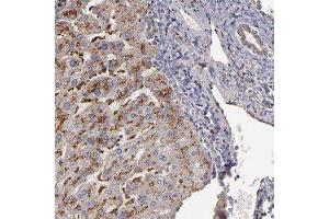 Immunohistochemical staining of human liver with TRAF1 polyclonal antibody  shows strong granular cytoplasmic positivity in hepatocytes. (TRAF1 anticorps)