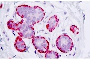 Human Breast: Formalin-Fixed, Paraffin-Embedded (FFPE)