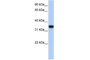 LDHA antibody used at 1 ug/ml to detect target protein. (Lactate Dehydrogenase A anticorps  (Middle Region))