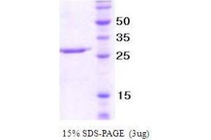 Figure annotation denotes ug of protein loaded and % gel used. (NCR/Nkp46 Protéine)