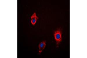 Immunofluorescent analysis of Cytochrome P450 3A4/5 staining in HepG2 cells. (Cytochrome P450 3A4, 3A5 (Center) anticorps)