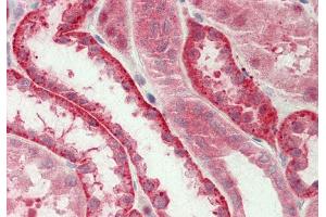 Rabbit Anti-Ubl5 antibody Catalog Number: ARP56285 Formalin Fixed Paraffin Embedded Tissue: Human Kidney Primary antibody Concentration: 1:100 Secondary Antibody: Donkey anti-Rabbit-Cy3 Secondary Antibody Concentration: 1:200 Magnification: 20x Exposure Time: 0.