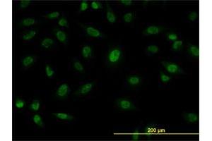 Immunofluorescence of monoclonal antibody to SFPQ on HeLa cell.