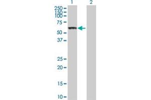 Western Blot analysis of CES1 expression in transfected 293T cell line by CES1 MaxPab polyclonal antibody.