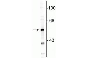 Western blot of rat cortical lysate showing specific immunolabeling of the ~50 kDa GFAP protein. (GFAP anticorps)