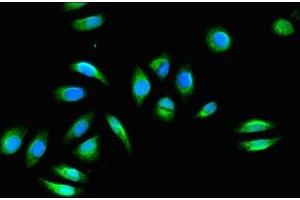 Immunofluorescent analysis of Hela cells using ABIN7153133 at dilution of 1:100 and Alexa Fluor 488-congugated AffiniPure Goat Anti-Rabbit IgG(H+L) (FHL2 anticorps  (AA 112-233))
