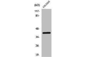Western Blot analysis of COLO205 cells using PKAα/β/γ cat Polyclonal Antibody (PRKACA + PRKACB + PRKACG anticorps)