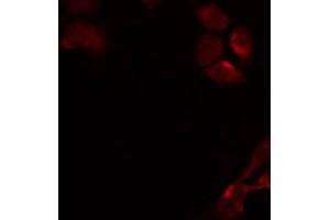 ABIN6274905 staining Hela by IF/ICC. (B3GALT4 anticorps  (Internal Region))