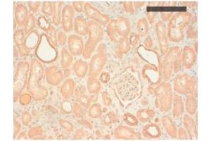 Image no. 1 for anti-Keratin Basic antibody (ABIN341107) (Keratin Basic anticorps)