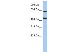 EFHA2 antibody used at 1 ug/ml to detect target protein. (EFHA2 anticorps  (N-Term))