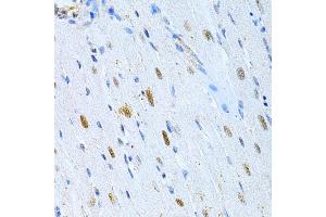 Immunohistochemistry of paraffin-embedded rat heart using M Antibody (ABIN3016264, ABIN3016265, ABIN3016266, ABIN1680752 and ABIN6219676) at dilution of 1:200 (40x lens).