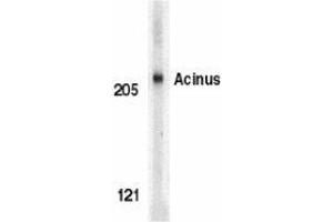 Western blot analysis of Acinus in K562 whole cell lysate with AP30012PU-N Acinus antibody (IN) at 1 μg/ml.