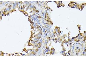 Immunohistochemistry of paraffin-embedded Rat lung using PSMB3 Polyclonal Antibody at dilution of 1:100 (40x lens). (PSMB3 anticorps)