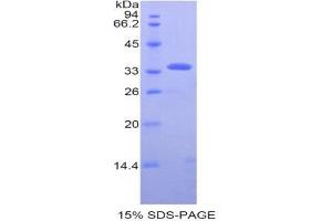 SDS-PAGE (SDS) image for Pyruvate Dehydrogenase beta (PDHB) (AA 31-341) protein (His tag) (ABIN1981024)