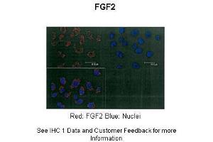 Sample Type :  Human A375 cells  Primary Antibody Dilution :  1:100  Secondary Antibody :  Anti-rabbit-Alexa-546  Secondary Antibody Dilution :  1:100  Color/Signal Descriptions :  Red: FGF2 Blue: Nuclei  Gene Name :  FGF2  Submitted by :  Igor Prudovsky, PhD, DSc, Principal Investigator, Center for Molecular Medicine, Maine Medical Center Research Institute, 81 Research Dr. (FGF2 anticorps  (Middle Region))
